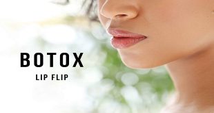 Botox lip flip technique Few Benefits and Guide about How does it work