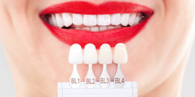 Common Myths About General Dentistry Debunked