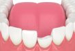 How To Fix Chipped, Cracked, Or Misaligned Teeth With Cosmetic Dentistry