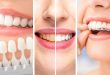 How To Transition From General Dental Care To Cosmetic Enhancements