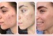 6 Steps To Ensure Your Cosmetic Results Last A Lifetime